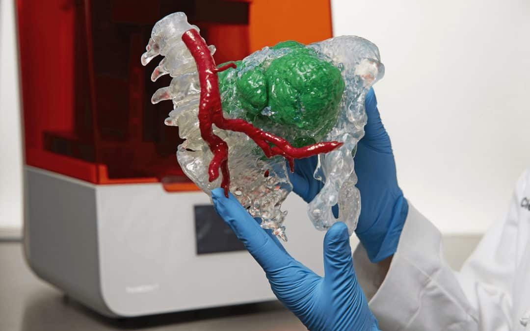 Imprimer des modèles anatomiques en 3D pour la planification préopératoire
