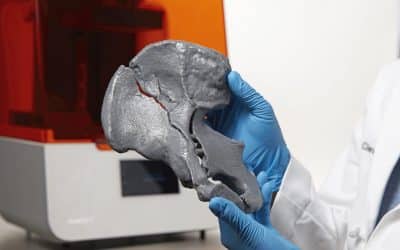 Applications d’impression 3D pour les hôpitaux et procédures spécifiques au patient