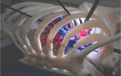 L’impression 3D couleur multimatériaux permet de modéliser la bio-texture des organes internes